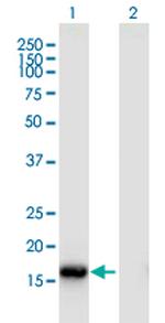 ROBO3 Antibody in Western Blot (WB)