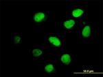 IKZF4 Antibody in Immunocytochemistry (ICC/IF)