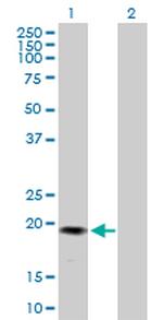 GREM2 Antibody in Western Blot (WB)