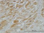 HHIP Antibody in Immunohistochemistry (Paraffin) (IHC (P))