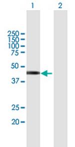 TSPY2 Antibody in Western Blot (WB)