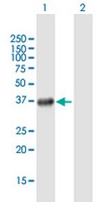 SMYD3 Antibody in Western Blot (WB)