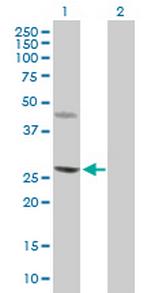 CERK Antibody in Western Blot (WB)