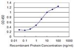 RBM15 Antibody in ELISA (ELISA)