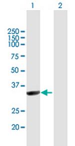 NMNAT1 Antibody in Western Blot (WB)