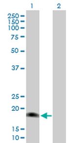 IL17E Antibody in Western Blot (WB)