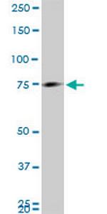 MARCH7 Antibody in Western Blot (WB)