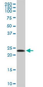 MRPL11 Antibody in Western Blot (WB)