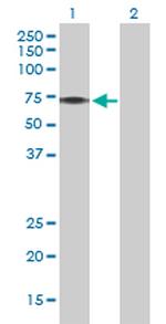 PINK1 Antibody in Western Blot (WB)