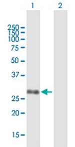 UBE2Z Antibody in Western Blot (WB)