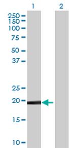 DUSP26 Antibody in Western Blot (WB)