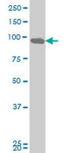 DDX54 Antibody in Western Blot (WB)