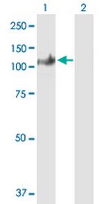 SECISBP2 Antibody in Western Blot (WB)