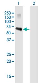 ZSCAN5A Antibody in Western Blot (WB)