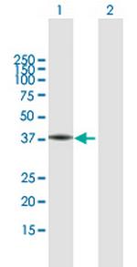 FA2H Antibody in Western Blot (WB)