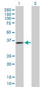 CRELD2 Antibody in Western Blot (WB)