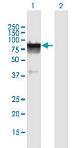 GLB1L Antibody in Western Blot (WB)