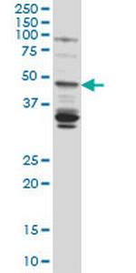 LASS4 Antibody in Western Blot (WB)