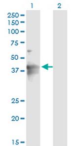 LASS4 Antibody in Western Blot (WB)