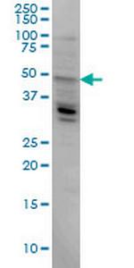 LASS4 Antibody in Western Blot (WB)