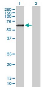 GALNT14 Antibody in Western Blot (WB)