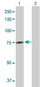 GALNT14 Antibody in Western Blot (WB)