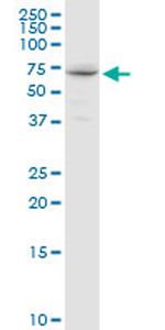 GALNT14 Antibody in Western Blot (WB)