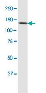 SMC6L1 Antibody in Western Blot (WB)