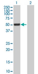 GAL3ST4 Antibody in Western Blot (WB)