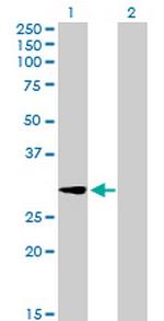 GALNT12 Antibody in Western Blot (WB)