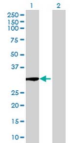 GALNT12 Antibody in Western Blot (WB)