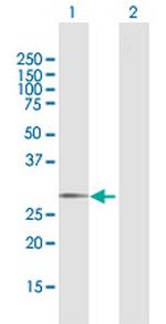 GALNT12 Antibody in Western Blot (WB)