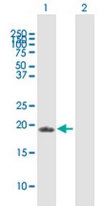 ZFAND1 Antibody in Western Blot (WB)