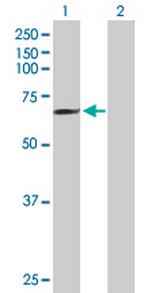 MCTP1 Antibody in Western Blot (WB)