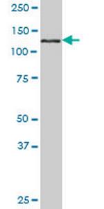 EHMT1 Antibody in Western Blot (WB)