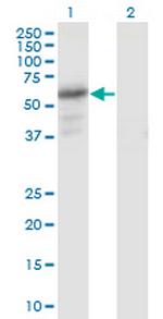 PDZD3 Antibody in Western Blot (WB)