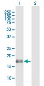 BAALC Antibody in Western Blot (WB)