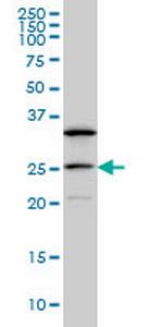 DCAKD Antibody in Western Blot (WB)