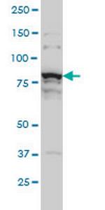 THNSL1 Antibody in Western Blot (WB)