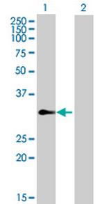 TCEAL4 Antibody in Western Blot (WB)