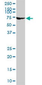 ADCK4 Antibody in Western Blot (WB)