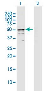 TRMT2B Antibody in Western Blot (WB)