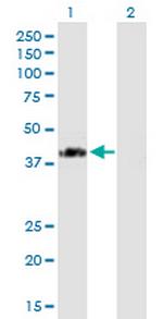 SPG11 Antibody in Western Blot (WB)