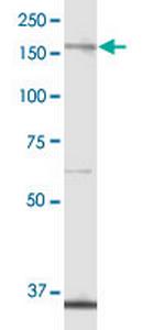 ALPK1 Antibody in Western Blot (WB)