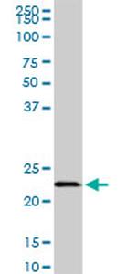 EFHD1 Antibody in Western Blot (WB)