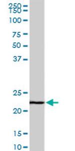 EFHD1 Antibody in Western Blot (WB)