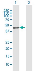 PUS1 Antibody in Western Blot (WB)