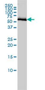 COASY Antibody in Western Blot (WB)