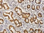 COASY Antibody in Immunohistochemistry (Paraffin) (IHC (P))