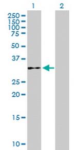 WDR61 Antibody in Western Blot (WB)